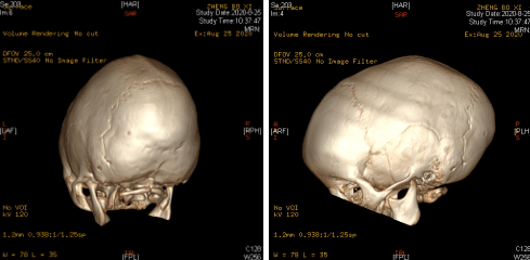 3D打印在医疗方面的应用现状