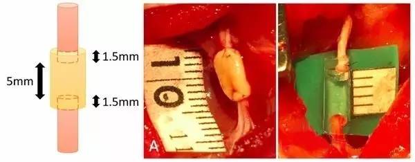 3D打印在医疗方面的应用现状